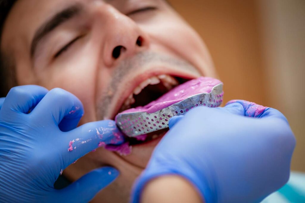 Dentista utilizando impresión dental para aparatos ortopédicos en un paciente