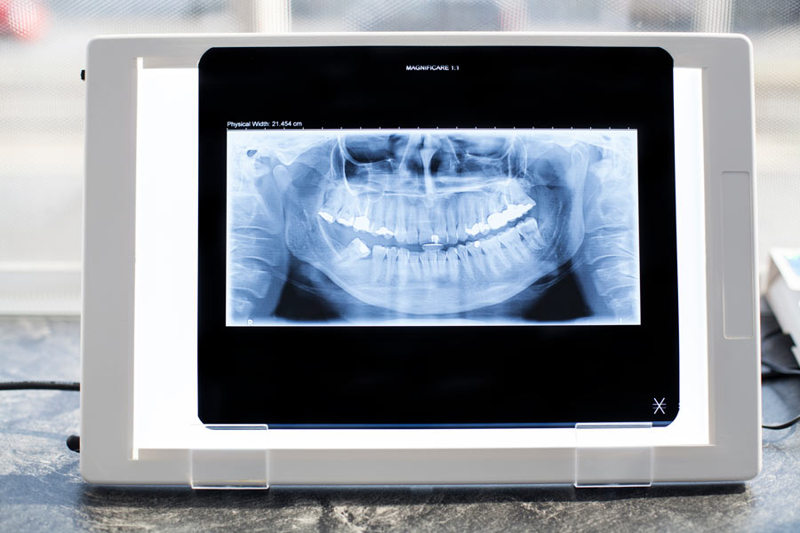 Radiografía panorámica dental en un visor de rayos X