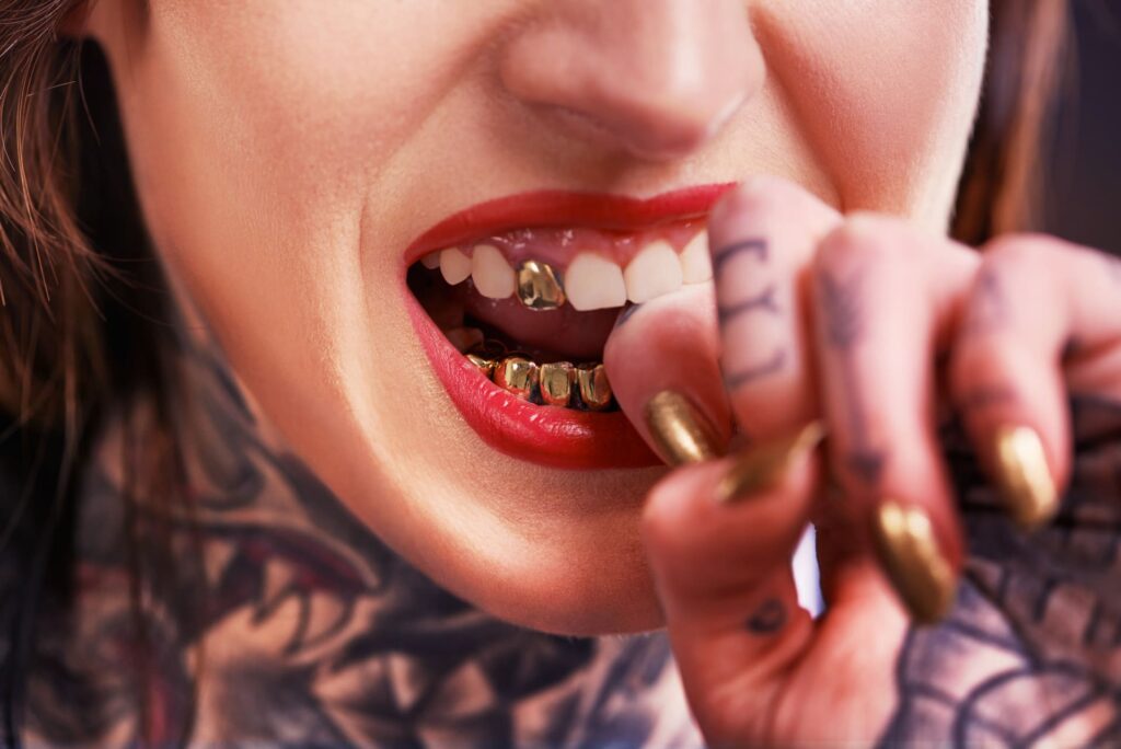 Persona mostrando grillz de oro removibles como tendencia de estética dental y moda urbana.